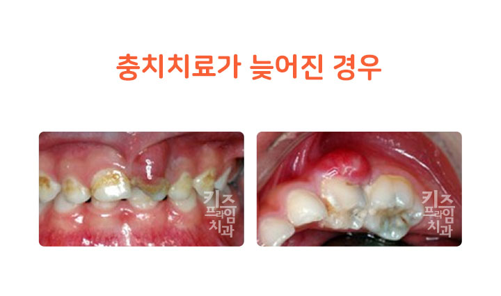 키즈프라임  