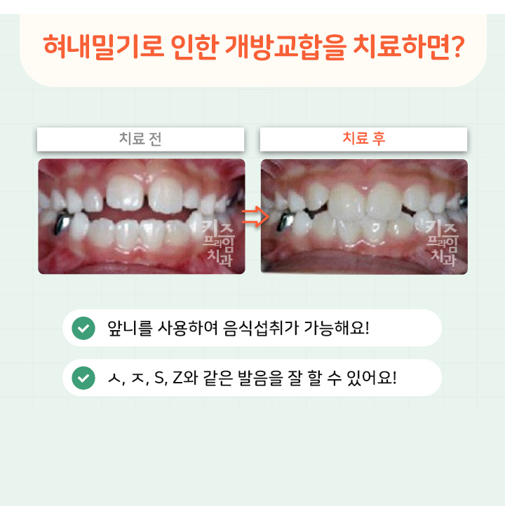 키즈프라임  