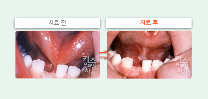 키즈프라임  