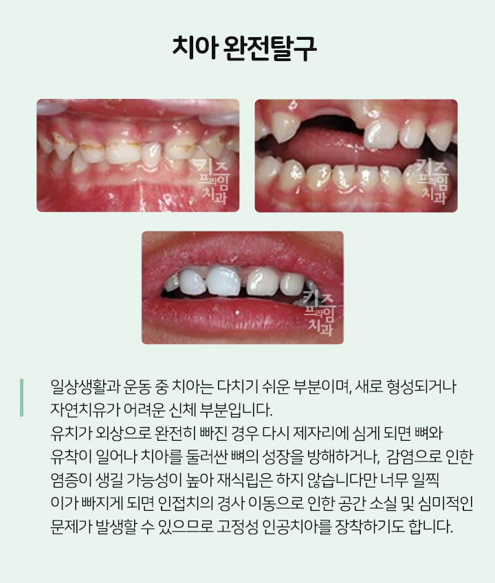 키즈프라임  