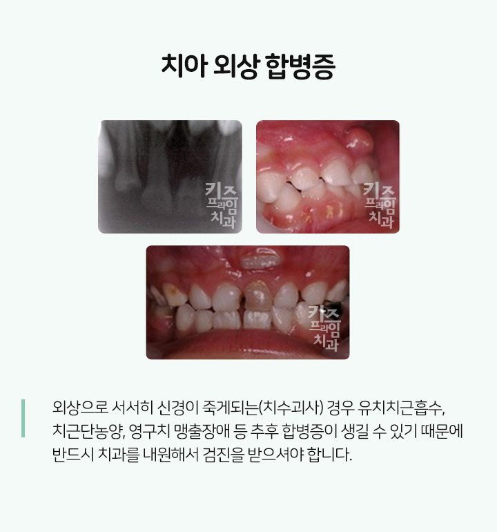 키즈프라임  