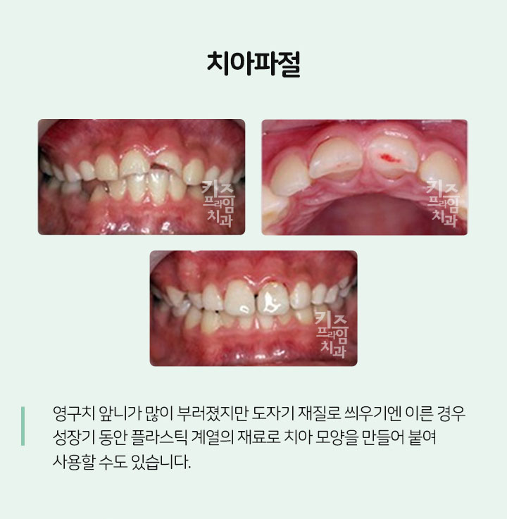 키즈프라임  