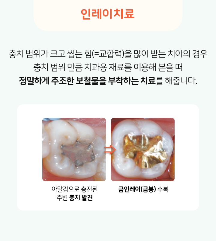 키즈프라임  