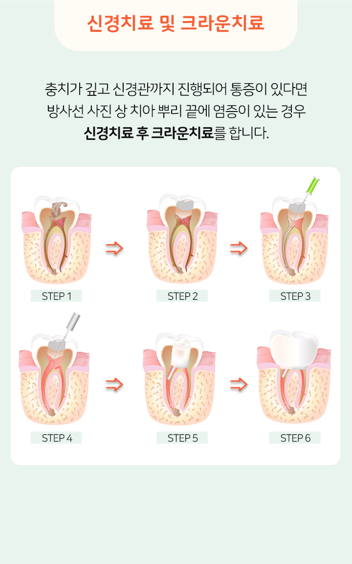 키즈프라임  