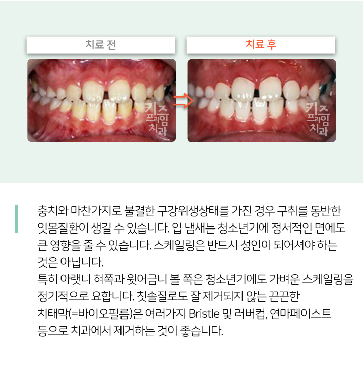 키즈프라임  