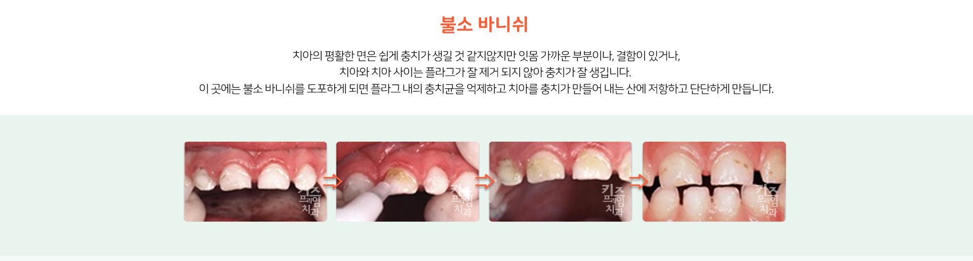 키즈프라임 