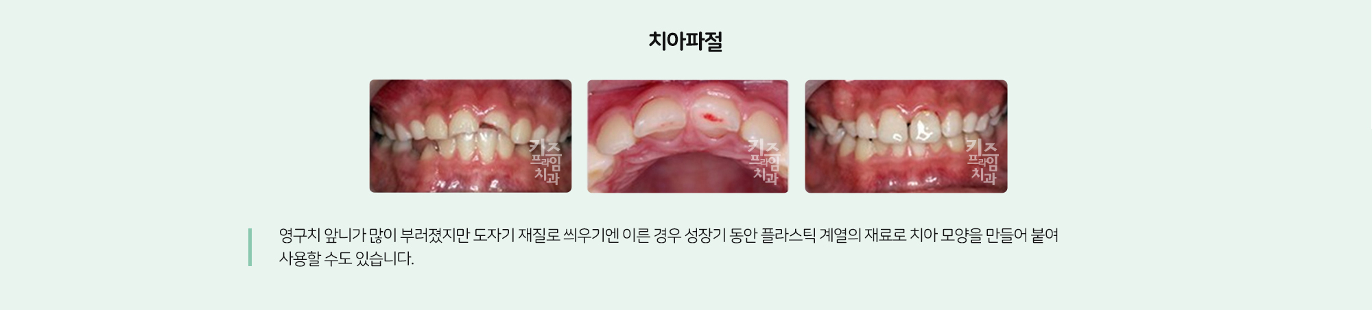 키즈프라임 