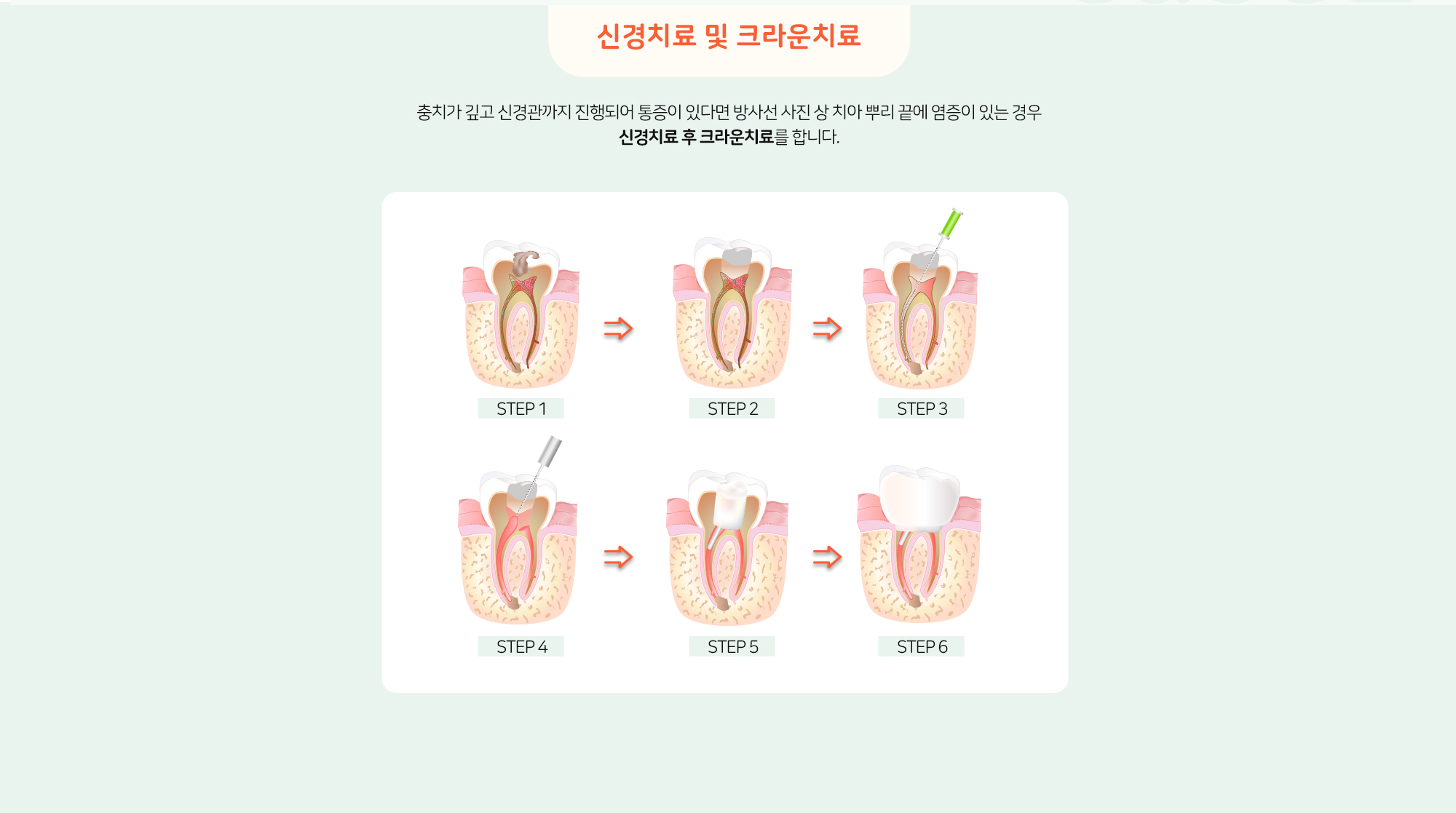 키즈프라임 