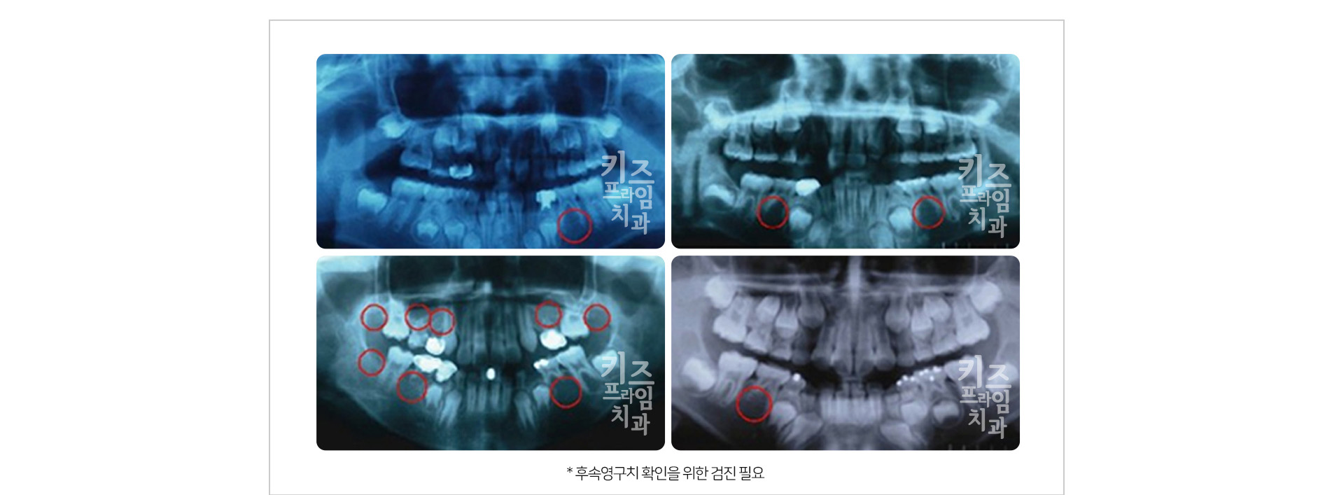 키즈프라임 