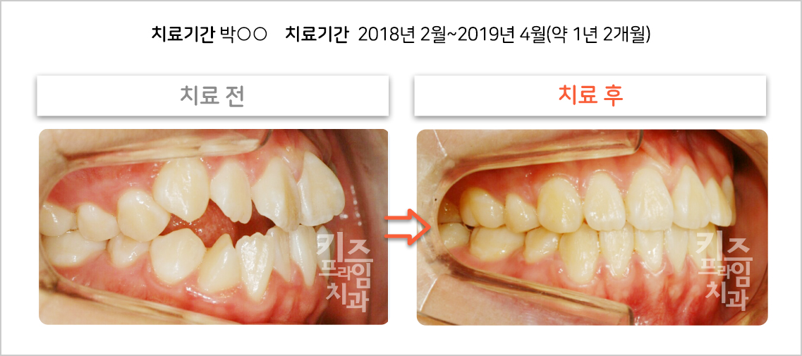 치료증례