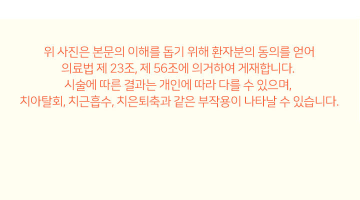 턱교정  