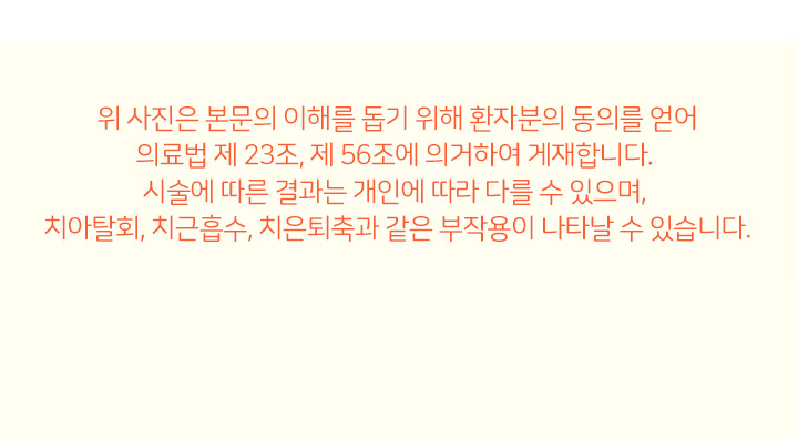 턱교정 