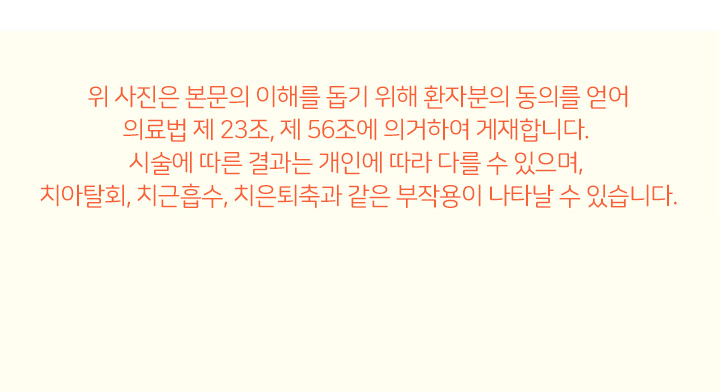 턱교정 