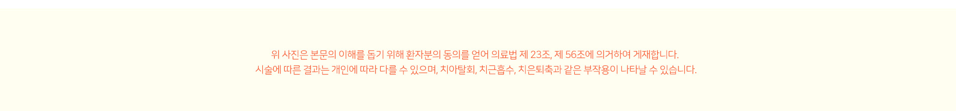 턱교정 